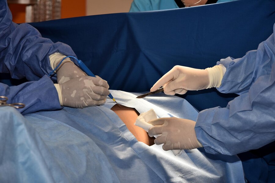 Joint Replacement Case